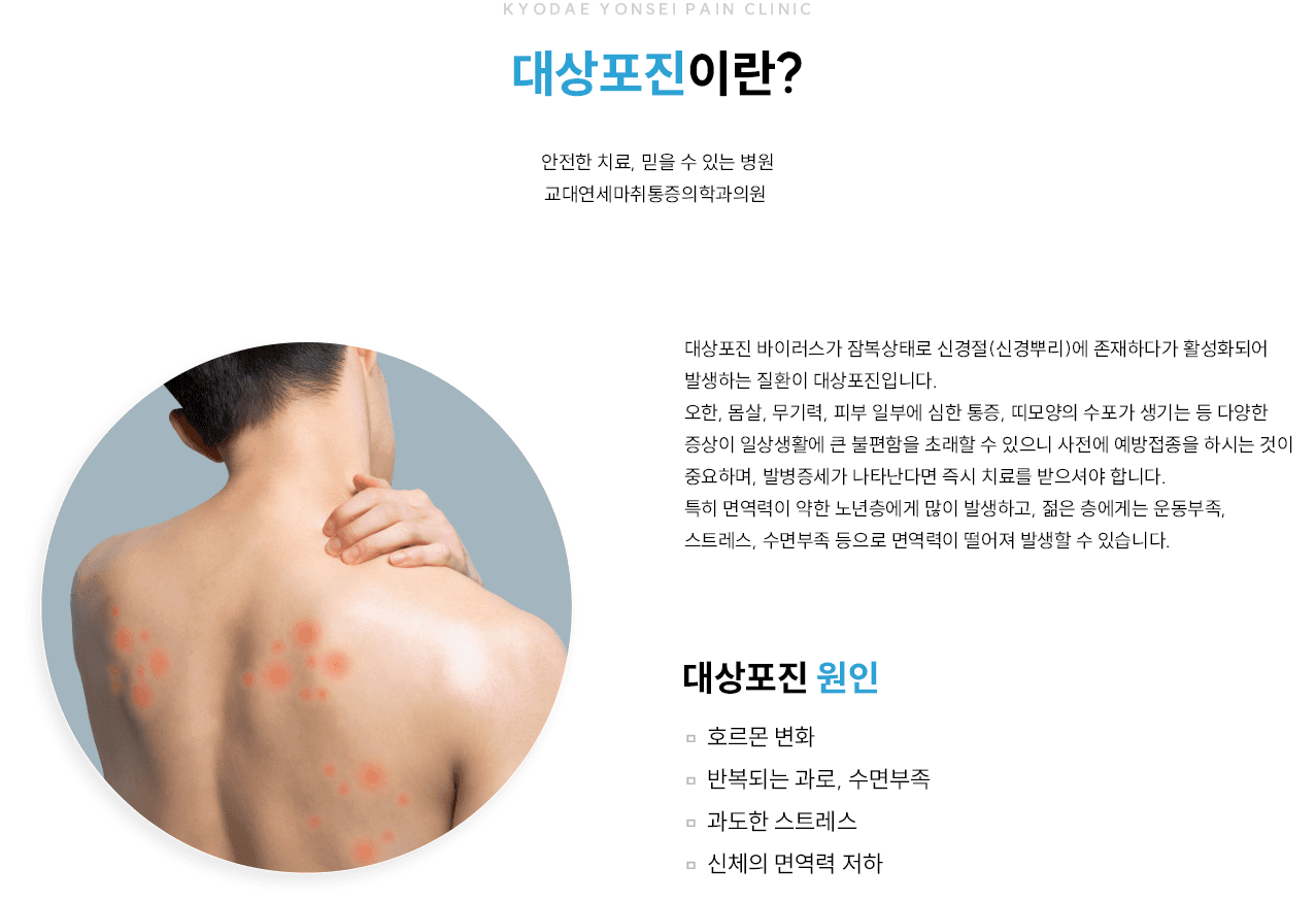 대상포진 개요와 원인 인포그래픽