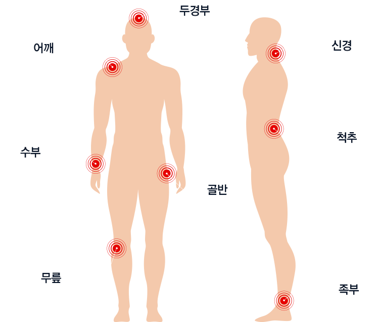 정면과 측면에서 통증이 자주 생기는 여덟 부위를 표시한 전신 그림